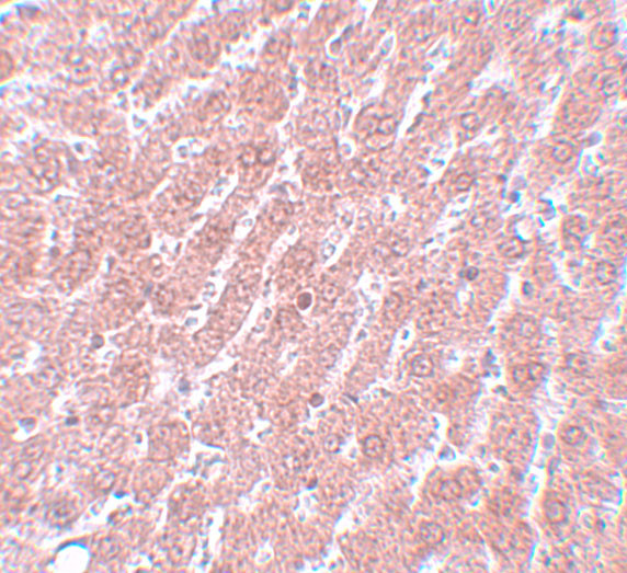 OCT4 Antibody in Immunohistochemistry (IHC)