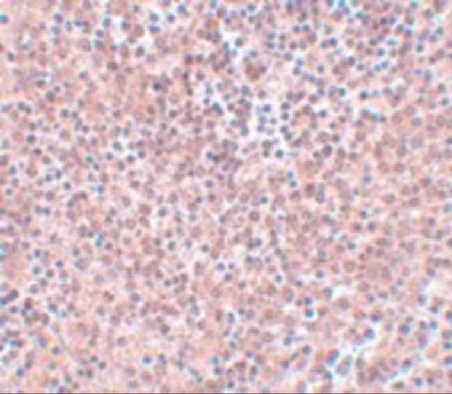 Nanog Antibody in Immunohistochemistry (IHC)