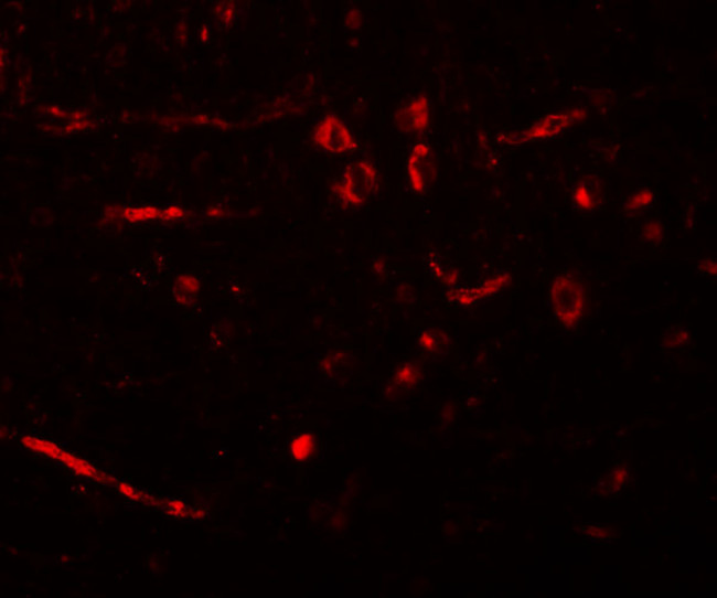 CDX2 Antibody in Immunohistochemistry (IHC)