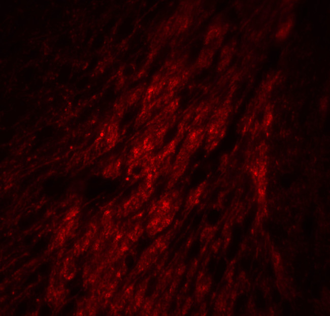 GATA3 Antibody in Immunohistochemistry (IHC)