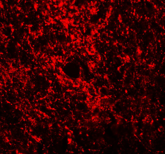 GATA3 Antibody in Immunohistochemistry (IHC)