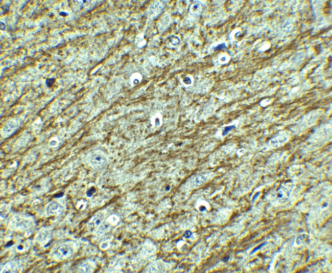 GATA3 Antibody in Immunohistochemistry (IHC)