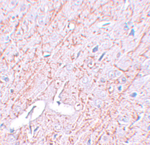 GATA3 Antibody in Immunohistochemistry (IHC)