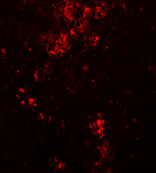 BFAR Antibody in Immunohistochemistry (IHC)