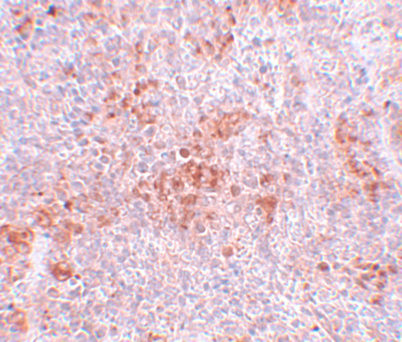 BFAR Antibody in Immunohistochemistry (IHC)