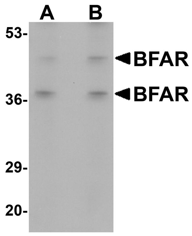 BFAR Antibody in Western Blot (WB)