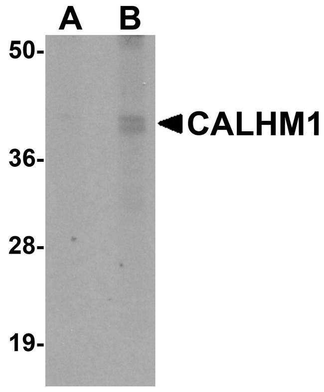 CALHM1 Antibody in Western Blot (WB)