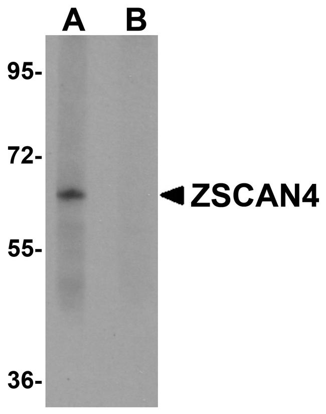 ZSCAN4 Antibody in Western Blot (WB)