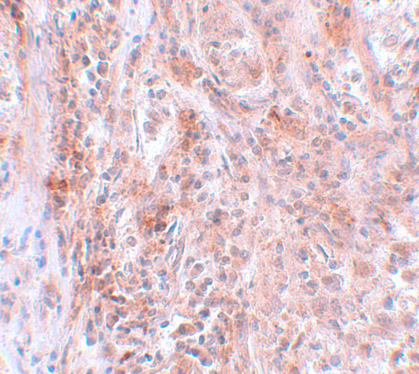 BCAS2 Antibody in Immunohistochemistry (IHC)