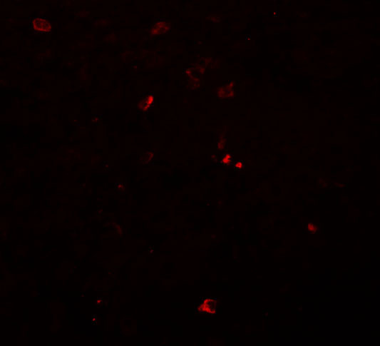 BCAS3 Antibody in Immunohistochemistry (IHC)