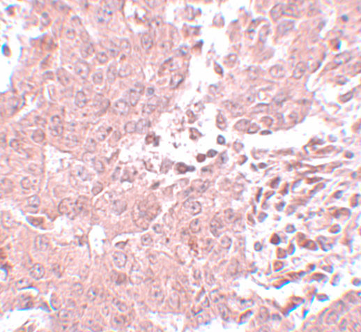 BCAS3 Antibody in Immunohistochemistry (IHC)