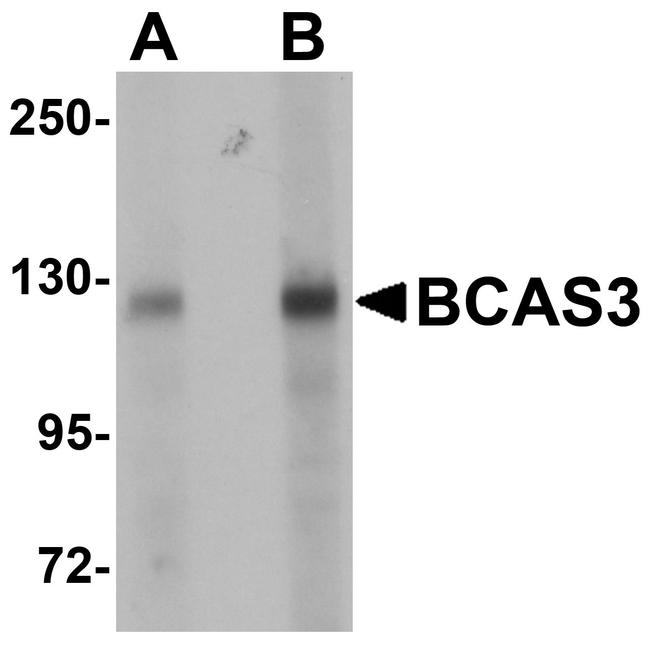 BCAS3 Antibody in Western Blot (WB)