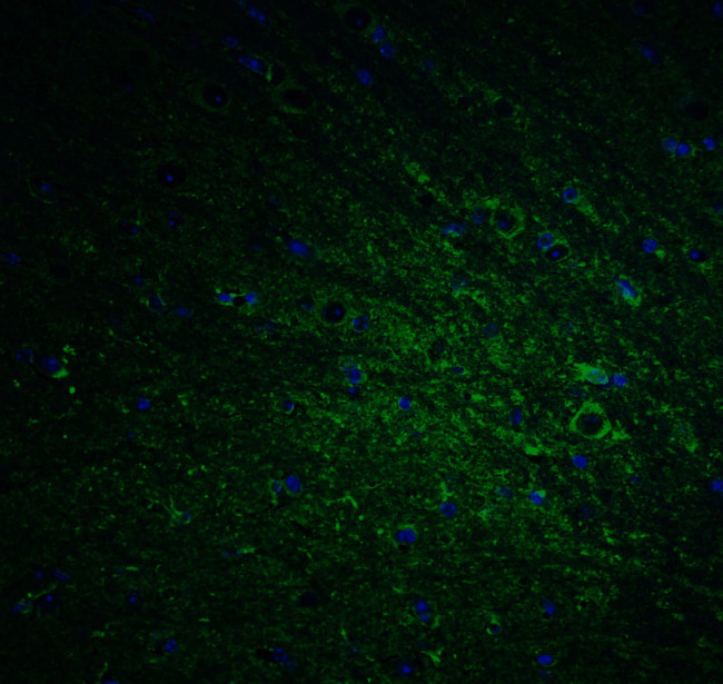 DCLK1 Antibody in Immunohistochemistry (IHC)