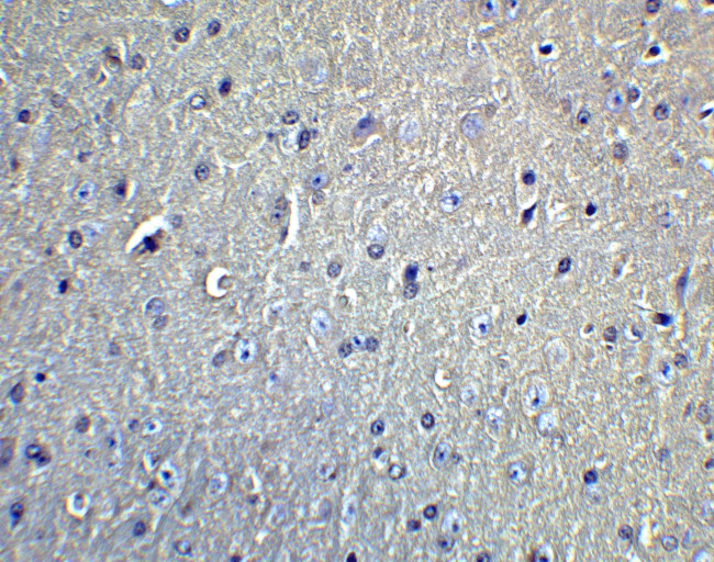 DCLK1 Antibody in Immunohistochemistry (IHC)