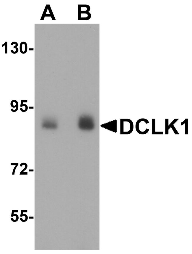 DCLK1 Antibody in Western Blot (WB)