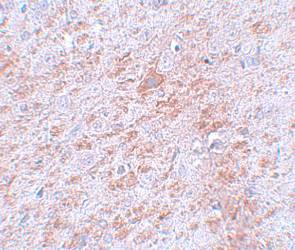 DCAMKL2 Antibody in Immunohistochemistry (IHC)