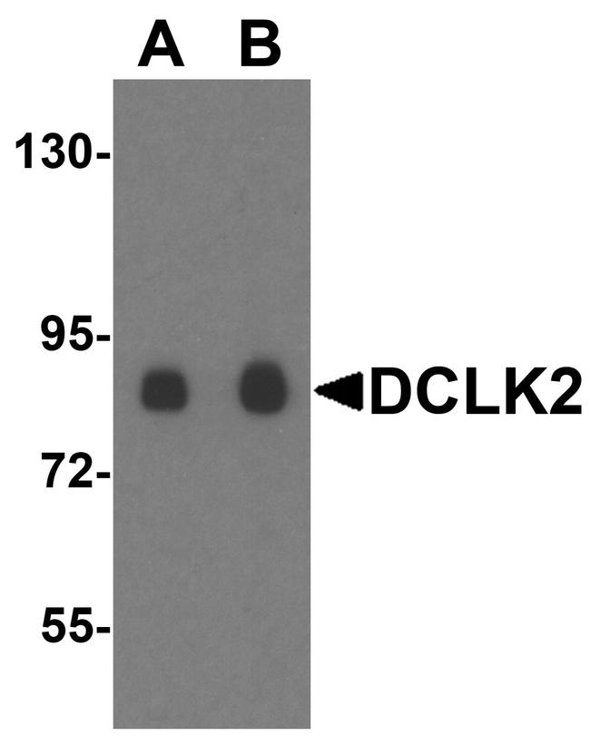 DCAMKL2 Antibody in Western Blot (WB)