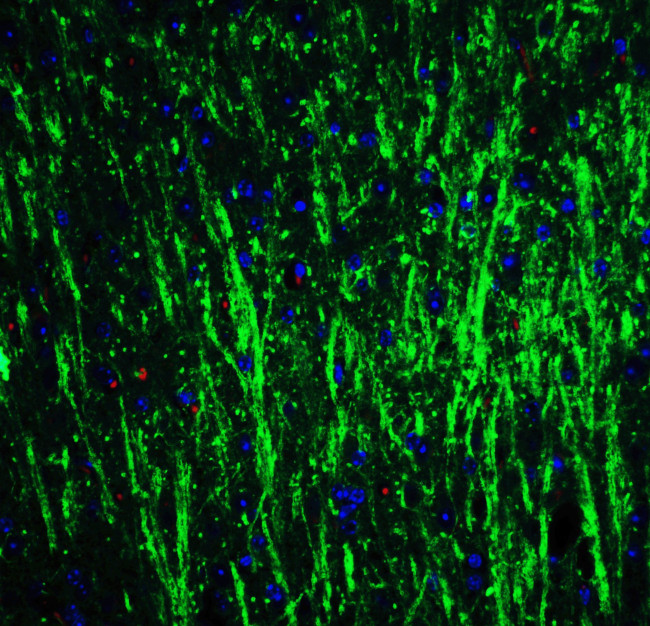 DCLK3 Antibody in Immunohistochemistry (IHC)