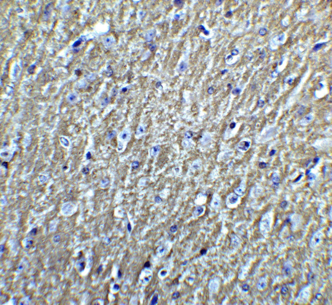 DCLK3 Antibody in Immunohistochemistry (IHC)