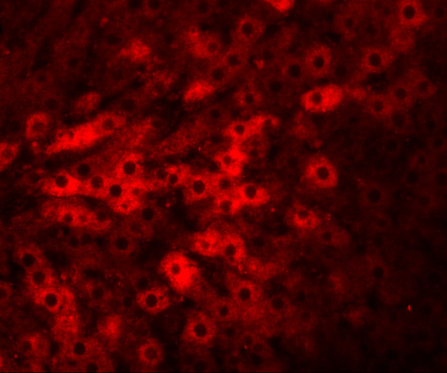 TMEM70 Antibody in Immunohistochemistry (IHC)