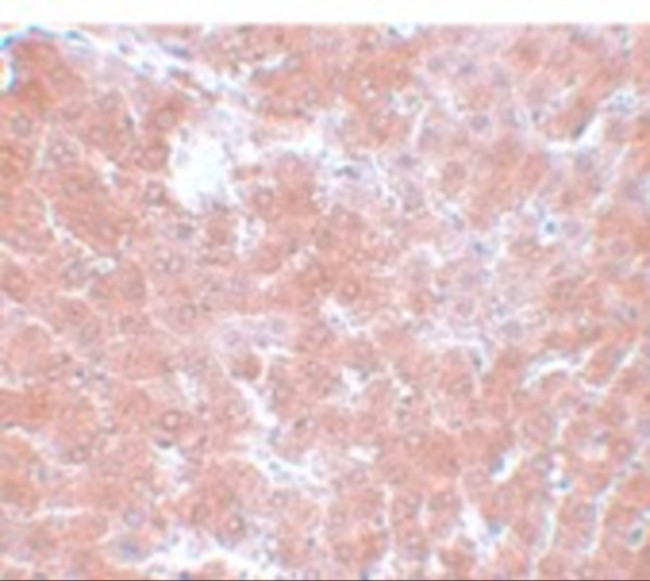 TMEM70 Antibody in Immunohistochemistry (IHC)