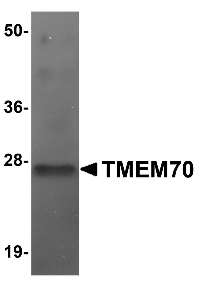 TMEM70 Antibody in Western Blot (WB)