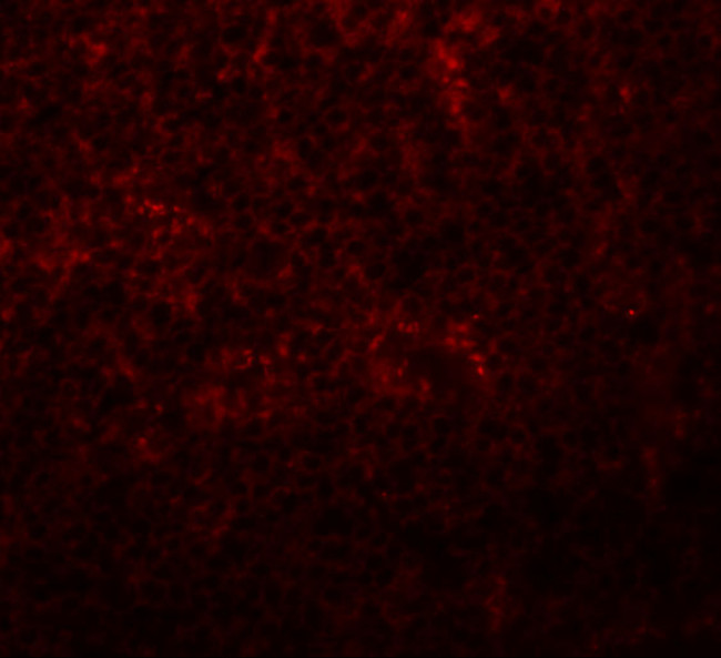 SLC37A2 Antibody in Immunohistochemistry (IHC)