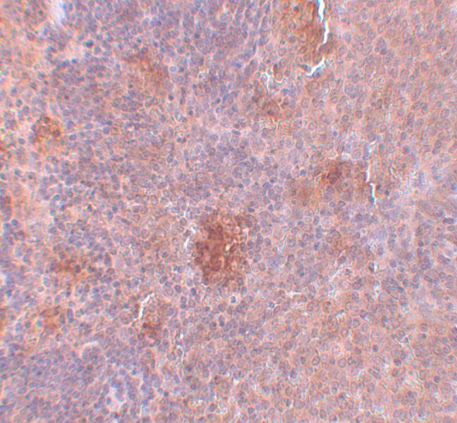 SLC37A2 Antibody in Immunohistochemistry (IHC)