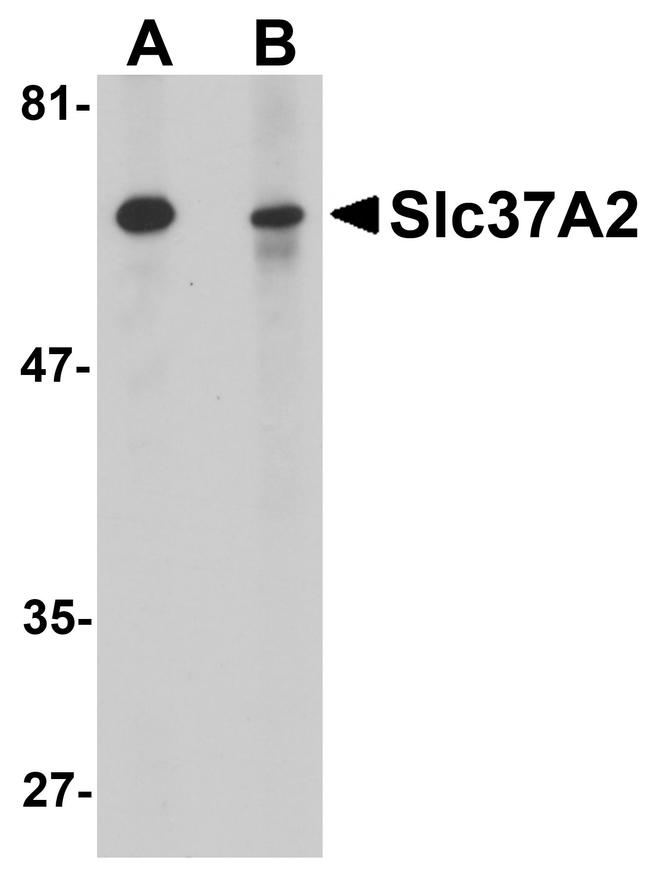 SLC37A2 Antibody in Western Blot (WB)