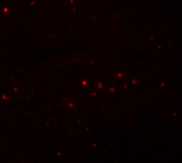 EFHD1 Antibody in Immunohistochemistry (IHC)