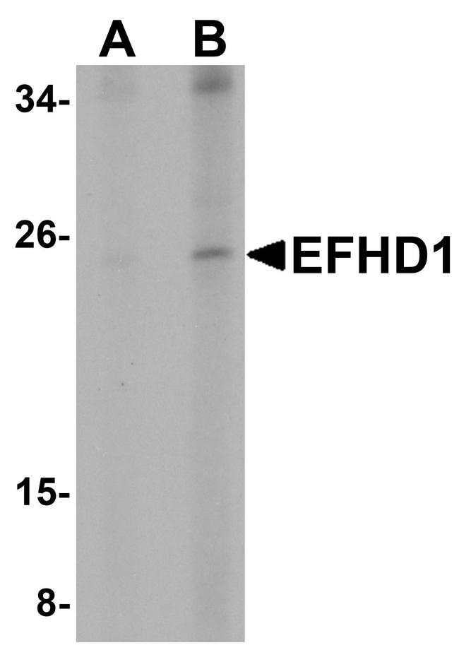 EFHD1 Antibody in Western Blot (WB)