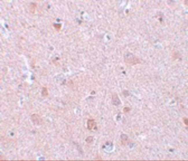 EFHD2 Antibody in Immunohistochemistry (IHC)