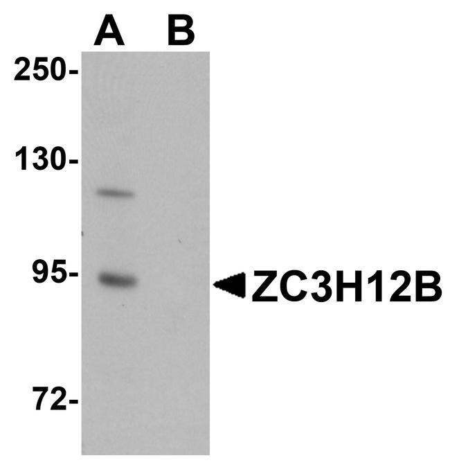 ZC3H12B Antibody in Western Blot (WB)