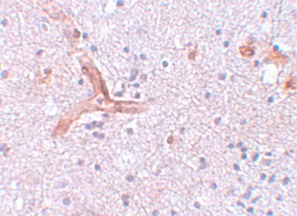 ZC3H12C Antibody in Immunohistochemistry (IHC)