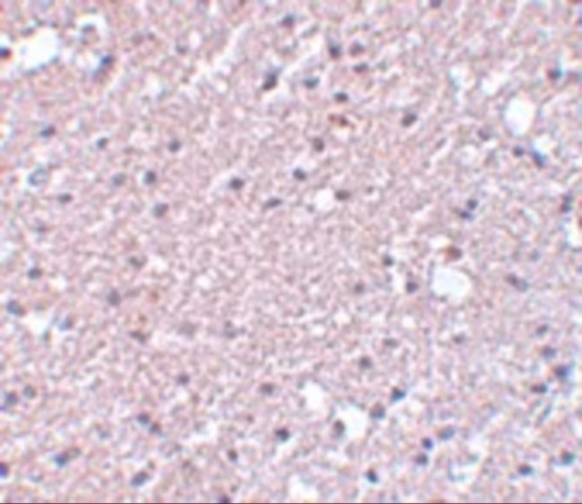 TMEM184A Antibody in Immunohistochemistry (IHC)