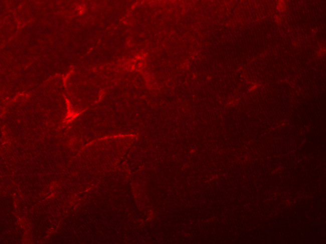 ADAMTSL5 Antibody in Immunohistochemistry (IHC)