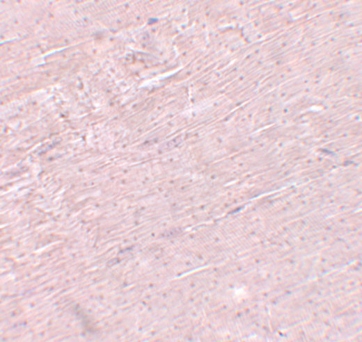 ADAMTSL5 Antibody in Immunohistochemistry (IHC)