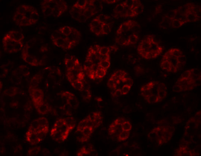 ENC1 Antibody in Immunohistochemistry (IHC)