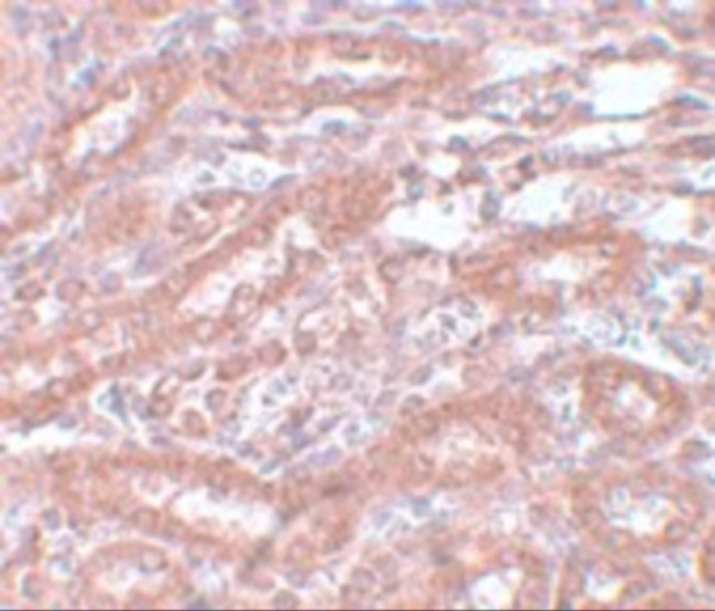 ENC1 Antibody in Immunohistochemistry (IHC)