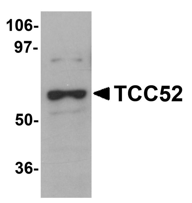 DCAF12 Antibody in Western Blot (WB)