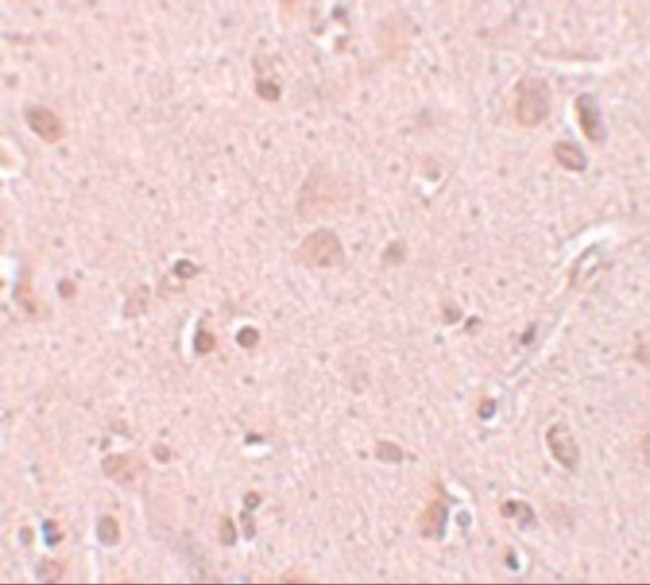 NSA2 Antibody in Immunohistochemistry (IHC)