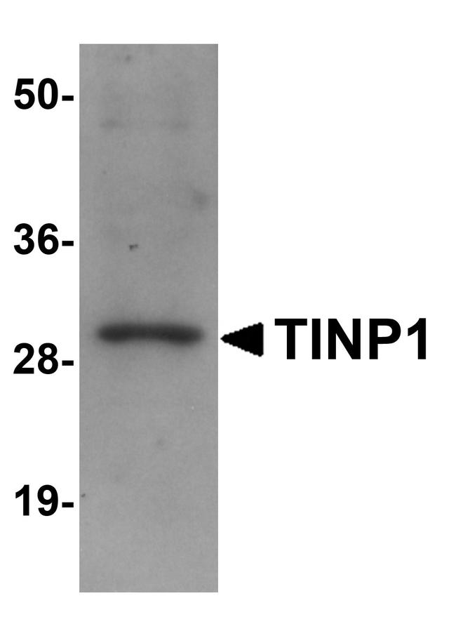 NSA2 Antibody in Western Blot (WB)