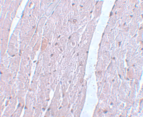 APC10 Antibody in Immunohistochemistry (IHC)