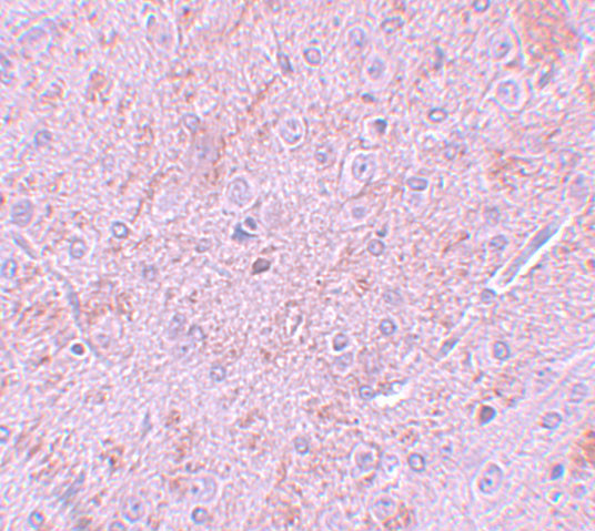 PIAS2 Antibody in Immunohistochemistry (IHC)