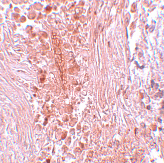 PIAS3 Antibody in Immunohistochemistry (IHC)