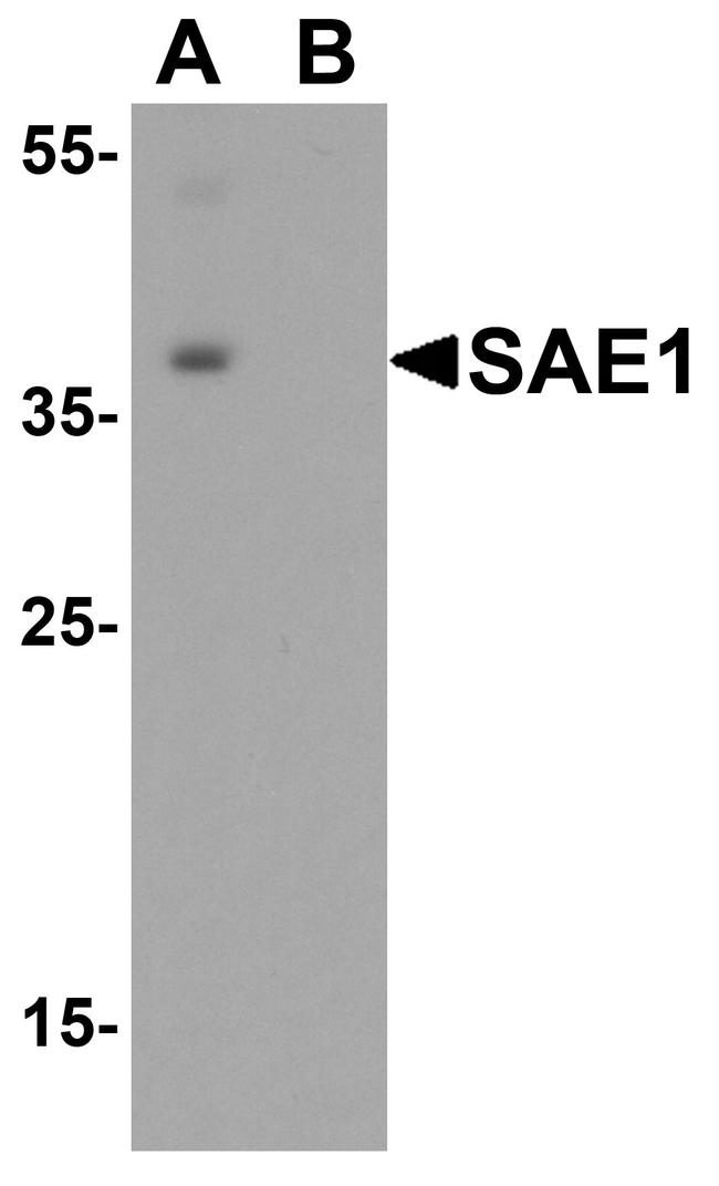 SAE1 Antibody in Western Blot (WB)