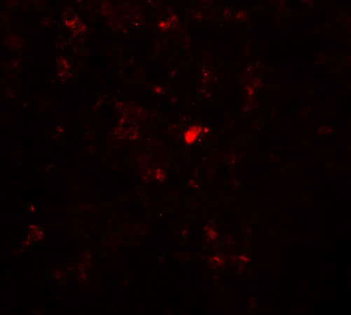 CtIP Antibody in Immunohistochemistry (IHC)