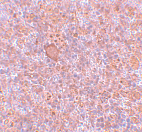 CtIP Antibody in Immunohistochemistry (IHC)