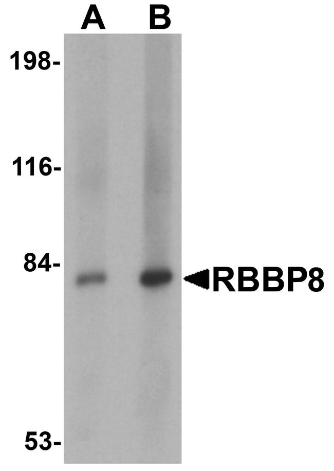 CtIP Antibody in Western Blot (WB)