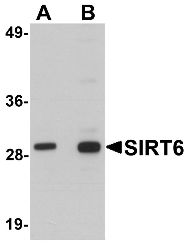 SIRT6 Antibody in Western Blot (WB)